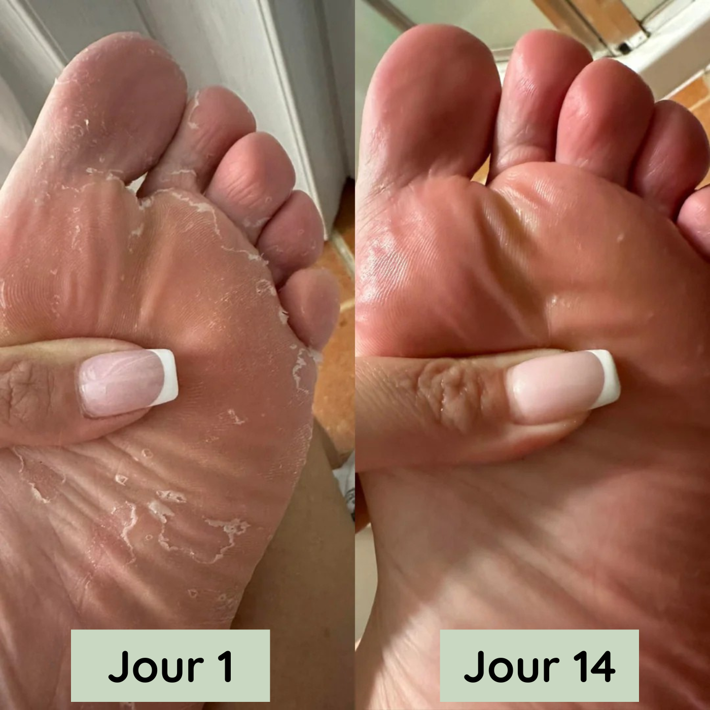 Résultat après 14 jours — Marie L.