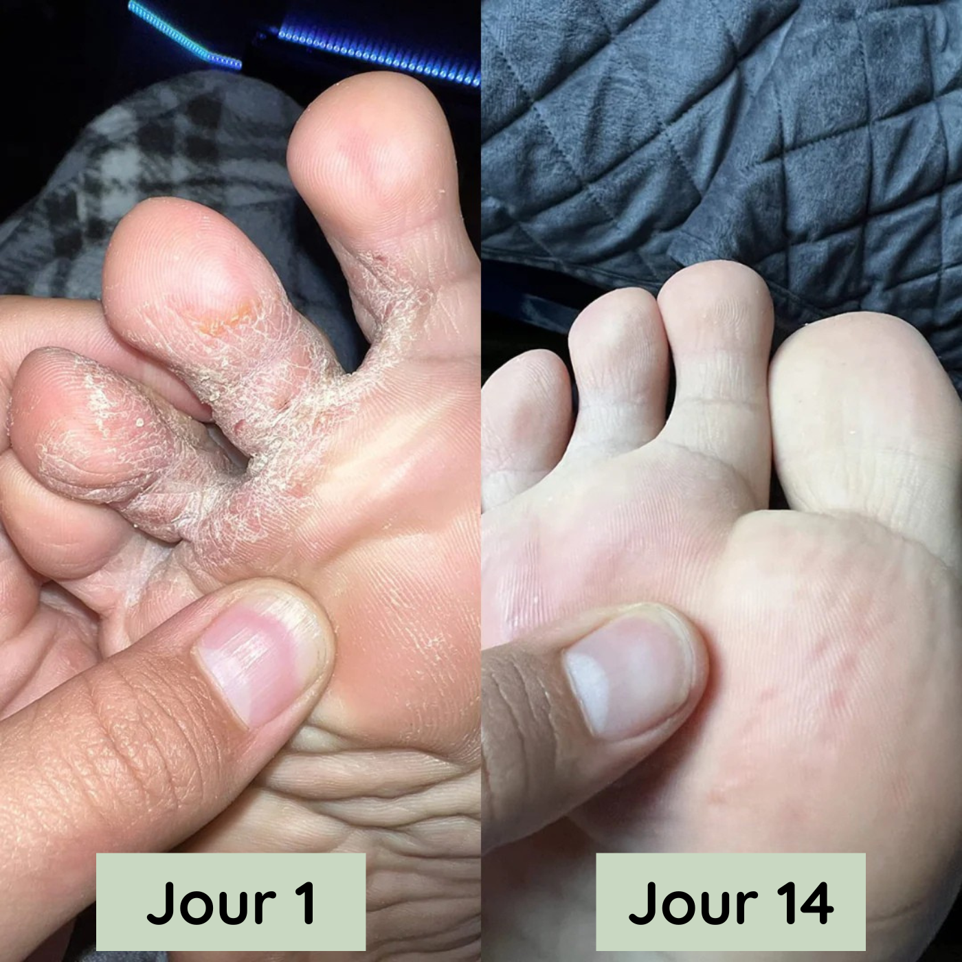 Résultat après 14 jours — Sophie M.